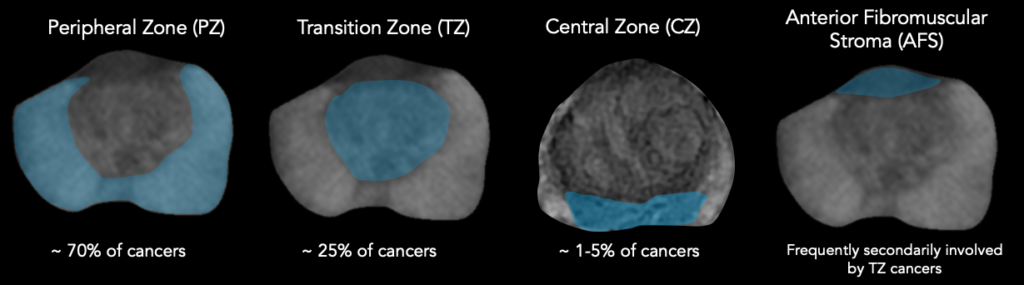 Prostate MRI - RAD-ASSIST