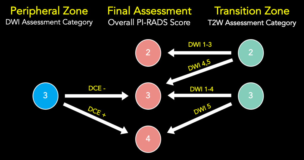Precise Score Prostate Prostate MRI - RAD-ASSIST